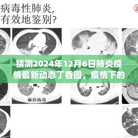 预测未来暖心日常，丁香园展望2024年肺炎疫情最新动态与温馨故事